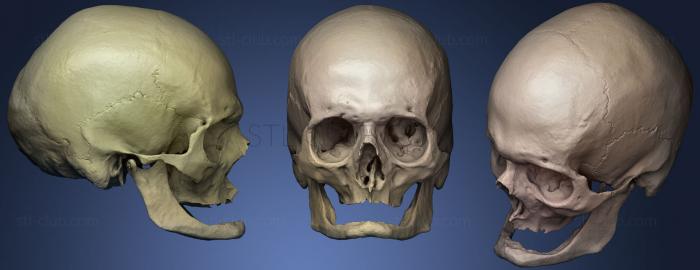 3D модель Череп Пожилого кавказца (STL)