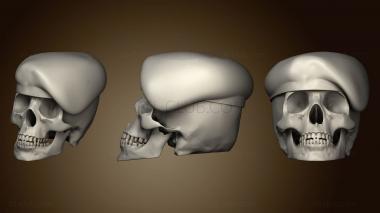 3D модель CRANEO REPARADO (STL)