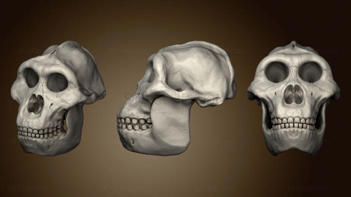 Анатомия скелеты и черепа Парантроп Босей 77
