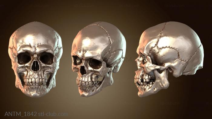 Анатомия скелеты и черепа Черепа-армяне