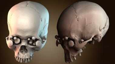 3D модель Грибовидная голова череп (STL)