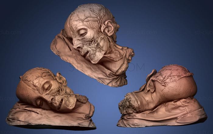 3D model Distribucin vascular de la cabeza (STL)