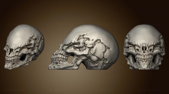 3D model Blind Skull (STL)