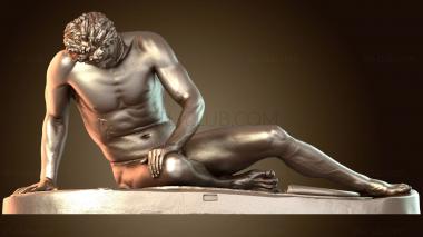 3D мадэль Умирающая Галлия Эллинистический период до н. э. Капитолийские музеи (STL)