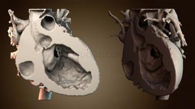 3D модель NS_4675 (STL)
