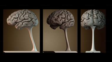 3D модель Сияющий мозг по данным МРТ (STL)