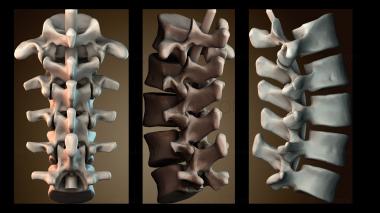 3D модель Поясничные позвонки (STL)