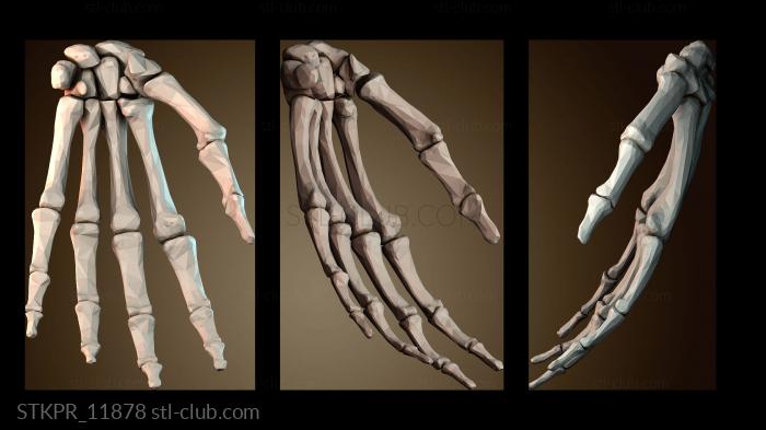 Кость руки левая