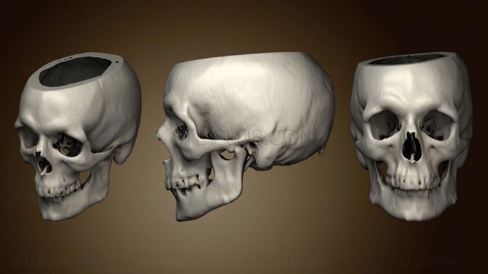 Skull Male 48yo